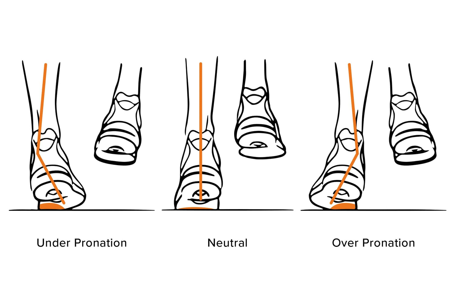 Gait Analysis Page Artboard