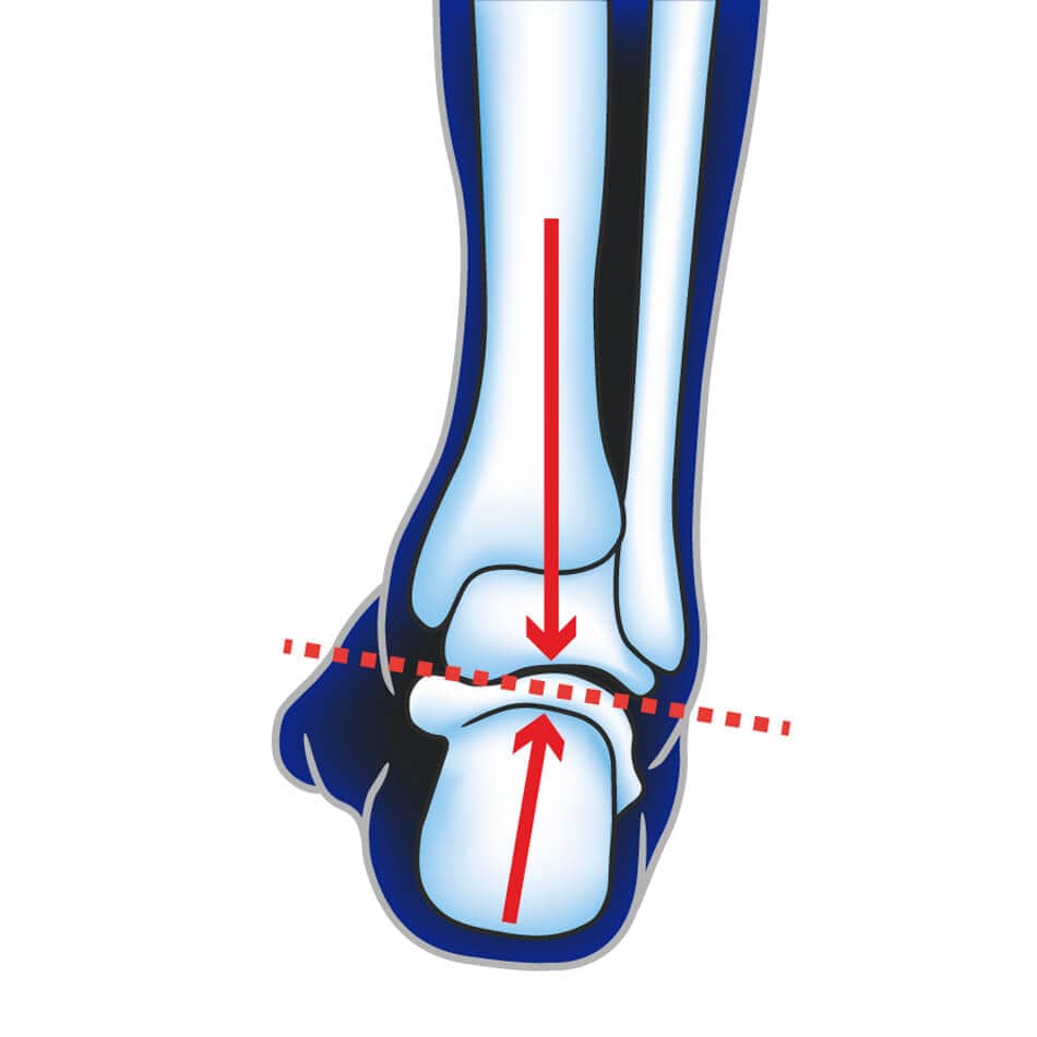 Ultimate Performance Accessories Ultimate Performance Advanced Insole With F3D AW23 - Up and Running